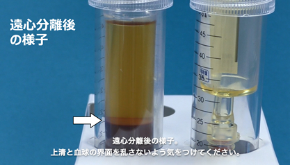 遠心分離後の様子。上清と血球の界面を乱さないよう気をつけてください。