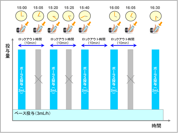 図3: PCAの設定 パラメータ概念図(持続投与、ボーラス投与、ロックアウト時間)